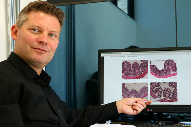 Tratamiento para cardiopatías podría usarse en la colitis&nbsp;crónica