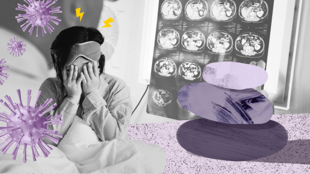 Reportan secuelas neurológicas, psiquiátricas o cognitivas tras COVID-19 en al menos uno de cada tres&nbsp;casos